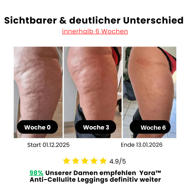 Yara™️ Anti-Cellulite Leggings